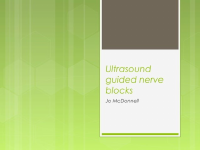 US guided nerve block.pptx